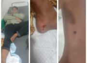 Polres Simalungun Amankan Pelaku Penembakan Massal di Perumahan Rorinata, 5 Warga Terluka