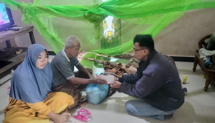Kayla, Bocah 6 Tahun Korban Luka Bakar Kini Menanti Kepedulian 
