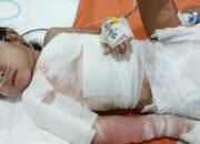 Tangis Kayla Berubah Jadi Senyum, Pasca Oprasi Kondisi Bocah Korban Luka Bakar Mulai Membaik